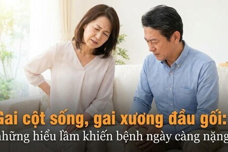 Gai cột sống, gai xương đầu gối: những hiểu lầm khiến bệnh càng nặng