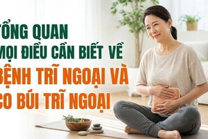 Tổng quan mọi điều cần biết về bệnh trĩ ngoại và co búi trĩ ngoại
