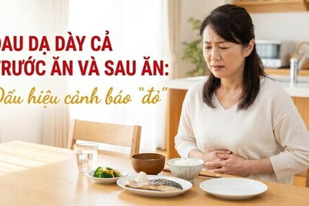 Đau dạ dày cả trước ăn và sau ăn: dấu hiệu cảnh báo "đỏ"