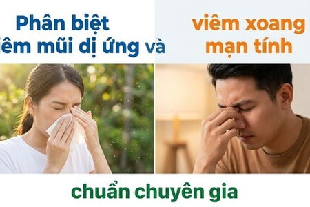 Phân biệt viêm mũi dị ứng và viêm xoang mạn tính chuẩn chuyên gia