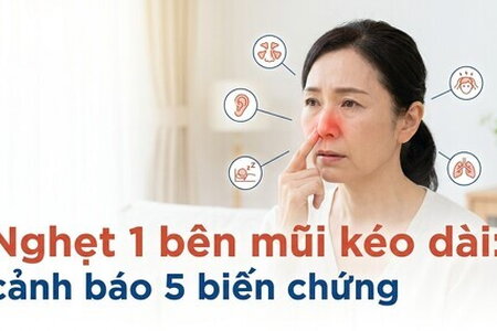 Nghẹt 1 bên mũi kéo dài: cảnh báo 5 biến chứng