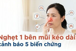 Nghẹt 1 bên mũi kéo dài: cảnh báo 5 biến chứng