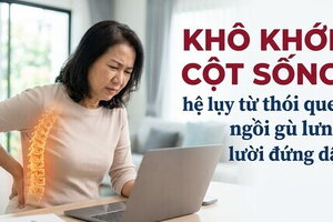 Khô khớp cột sống: hệ lụy từ thói quen ngồi gù lưng, lười đứng dậy