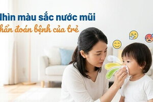 Nhìn màu sắc nước mũi chẩn đoán bệnh của trẻ