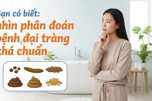 Bạn có biết: nhìn phân đoán bệnh đại tràng khá chuẩn