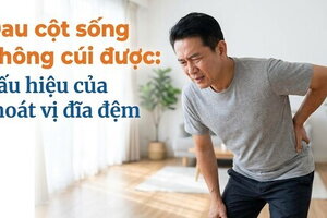 Đau cột sống không cúi được: dấu hiệu của thoát vị đĩa đệm