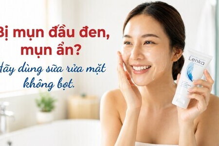 Bị mụn đầu đen, mụn ẩn? Hãy dùng sữa rửa mặt không bọt