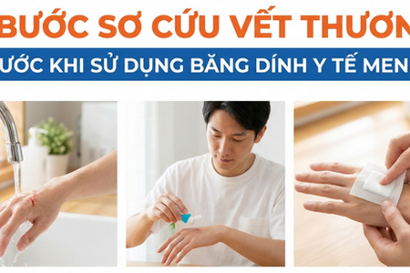 3 bước sơ cứu vết thương trước khi sử dụng Băng dính y tế MENKO
