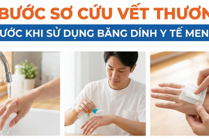 3 bước sơ cứu vết thương trước khi sử dụng Băng dính y tế MENKO