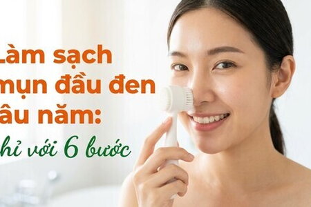 Làm sạch mụn đầu đen lâu năm: chỉ với 6 bước