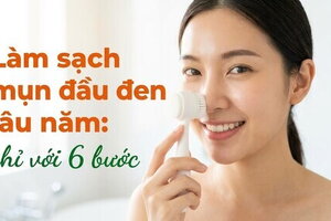 Làm sạch mụn đầu đen lâu năm: chỉ với 6 bước