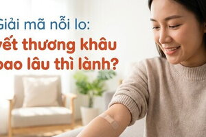 Giải mã nỗi lo: vết thương khâu bao lâu thì lành?