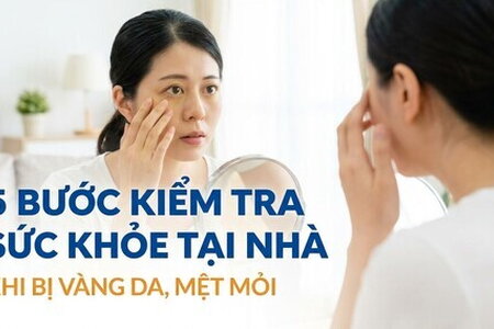 5 bước kiểm tra sức khỏe tại nhà khi bị vàng da, mệt mỏi
