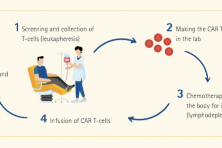 Điều trị bệnh bạch cầu bằng liệu pháp tế bào CAR-T