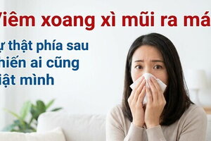 Viêm xoang xì mũi ra máu - sự thật phía sau khiến ai cũng giật mình