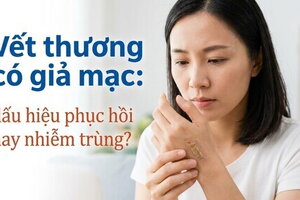 Vết thương có giả mạc: dấu hiệu phục hồi hay nhiễm trùng?