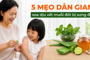 5 mẹo dân gian xoa dịu vết muỗi đốt bị sưng đỏ