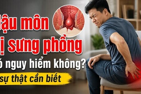 Hậu môn bị sưng phồng có nguy hiểm không? sự thật cần biết