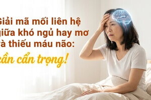 Giải mã mối liên hệ giữa khó ngủ hay mơ và thiếu máu não: cẩn trọng!