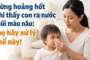 Đừng hoảng hốt khi thấy con ra nước mũi màu nâu: mẹ hãy xử lý thế này