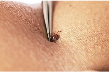 Mỹ: Virus Bourbon được phát hiện ở New York vẫn chưa có thuốc chữa