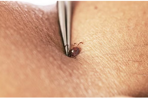 Mỹ: Virus Bourbon được phát hiện ở New York vẫn chưa có thuốc chữa
