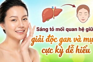 Sáng tỏ mối quan hệ giữa giải độc gan và mụn cực kỳ dễ hiểu