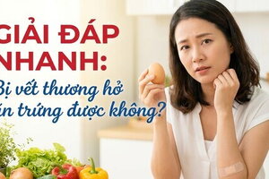 Giải đáp nhanh: bị vết thương hở ăn trứng được không?