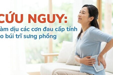 Cứu nguy: làm dịu các cơn đau cấp tính do búi trĩ sưng phồng