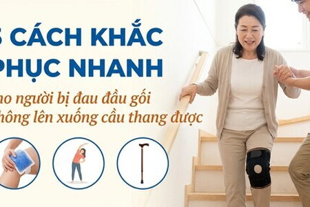 3 cách khắc phục cho người bị đau đầu gối không lên xuống cầu thang
