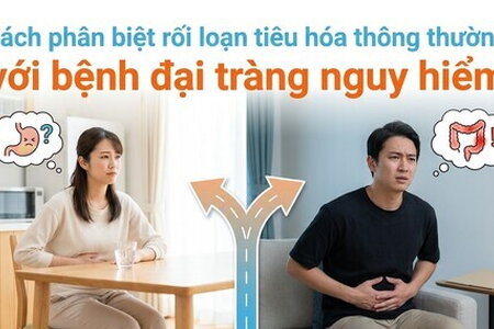 Cách phân biệt rối loạn tiêu hóa thông thường với bệnh đại tràng