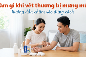Làm gì khi vết thương bị mưng mủ? hướng dẫn chăm sóc đúng cách