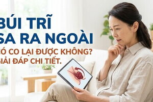 Búi trĩ sa ra ngoài có co lại được không? giải đáp chi tiết