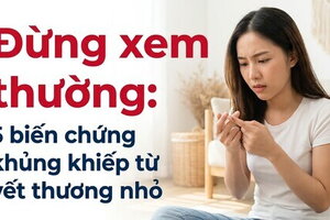 Đừng xem thường: 5 biến chứng khủng khiếp từ vết thương nhỏ