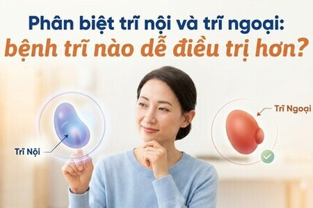 Phân biệt trĩ nội và trĩ ngoại: bệnh trĩ nào dễ điều trị hơn?