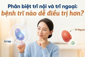Phân biệt trĩ nội và trĩ ngoại: bệnh trĩ nào dễ điều trị hơn?