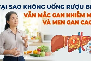 Tại sao không uống rượu bia vẫn mắc gan nhiễm mỡ và men gan cao?