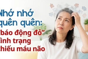 Nhớ nhớ quên quên: "báo động đỏ" tình trạng thiếu máu não