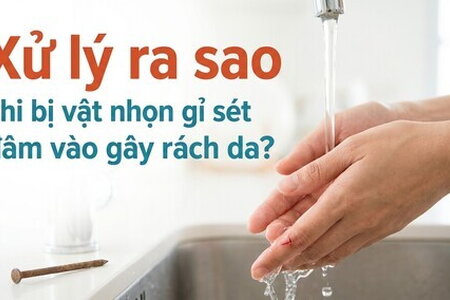Xử lý ra sao khi bị vật nhọn gỉ sét đâm vào gây rách da?