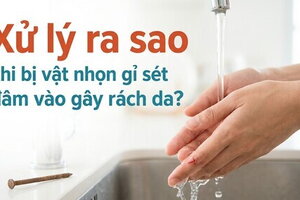 Xử lý ra sao khi bị vật nhọn gỉ sét đâm vào gây rách da?