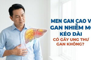 Men gan cao và gan nhiễm mỡ kéo dài có gây ung thư gan không?