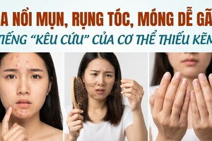 Da nổi mụn, rụng tóc, móng dễ gãy tiếng kêu cứu của cơ thể thiếu kẽm