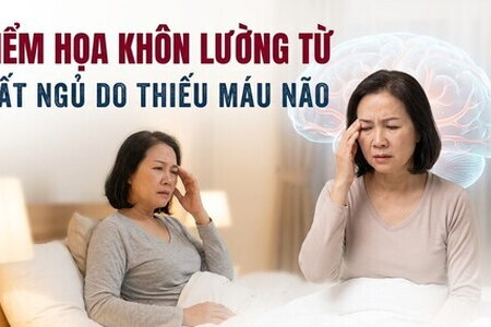 Hiểm họa khôn lường từ mất ngủ do thiếu máu não