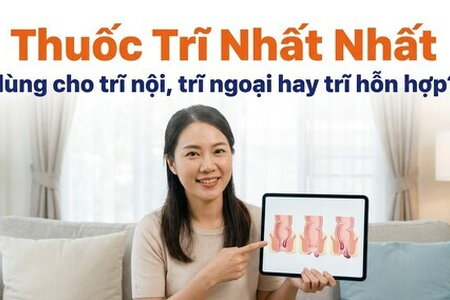Thuốc Trĩ Nhất Nhất dùng cho trĩ nội, trĩ ngoại hay trĩ hỗn hợp?
