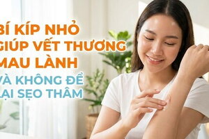 Bí kíp nhỏ giúp vết thương mau lành và không để lại sẹo thâm