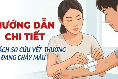 Hướng dẫn chi tiết cách sơ cứu vết thương đang chảy máu