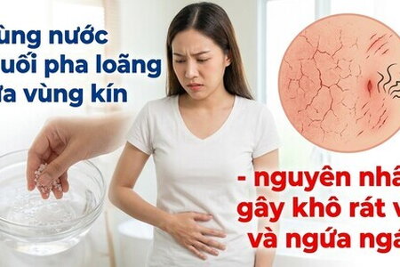 Dùng nước muối pha loãng rửa vùng kín - gây khô rát và ngứa ngáy