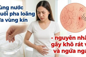 Dùng nước muối pha loãng rửa vùng kín - gây khô rát và ngứa ngáy