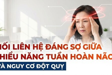 Mối liên hệ đáng sợ giữa thiểu năng tuần hoàn não và nguy cơ đột quỵ
