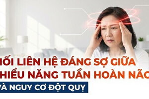 Mối liên hệ đáng sợ giữa thiểu năng tuần hoàn não và nguy cơ đột quỵ